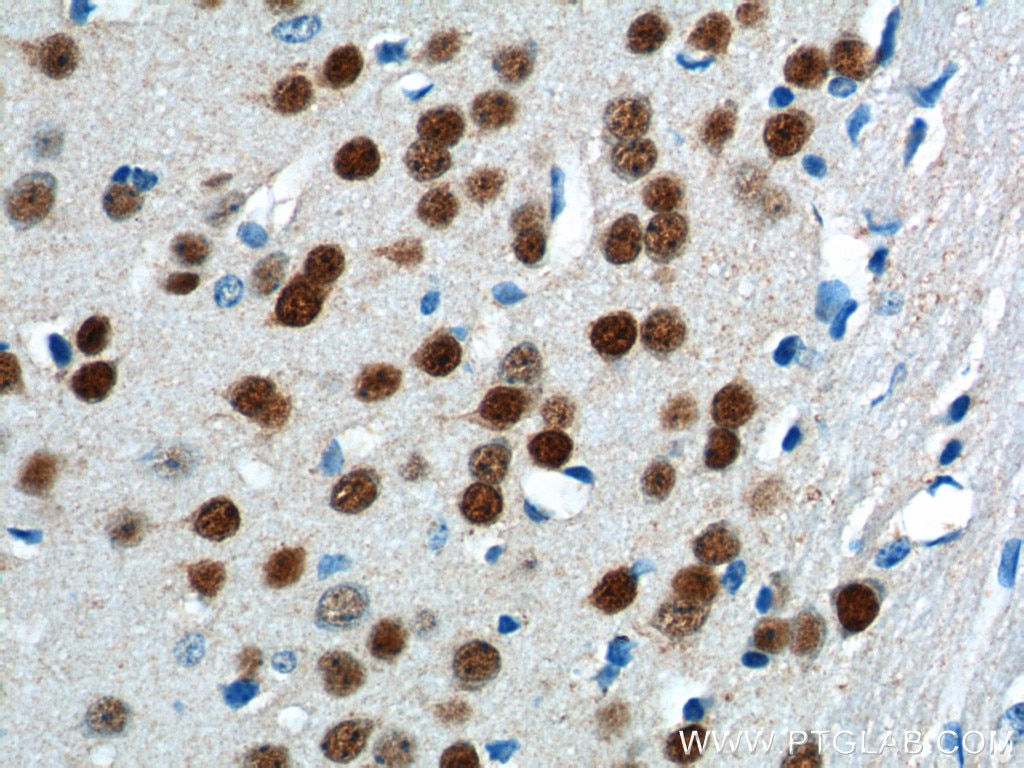 Immunohistochemistry (IHC) staining of mouse brain tissue using A2BP1 Polyclonal antibody (22647-1-AP)