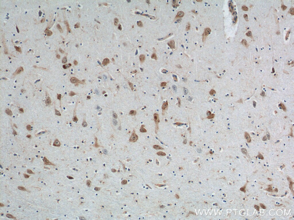 Immunohistochemistry (IHC) staining of human brain tissue using A2BP1 Polyclonal antibody (22647-1-AP)