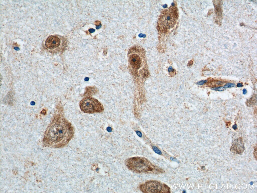 Immunohistochemistry (IHC) staining of human brain tissue using A2BP1 Polyclonal antibody (22647-1-AP)