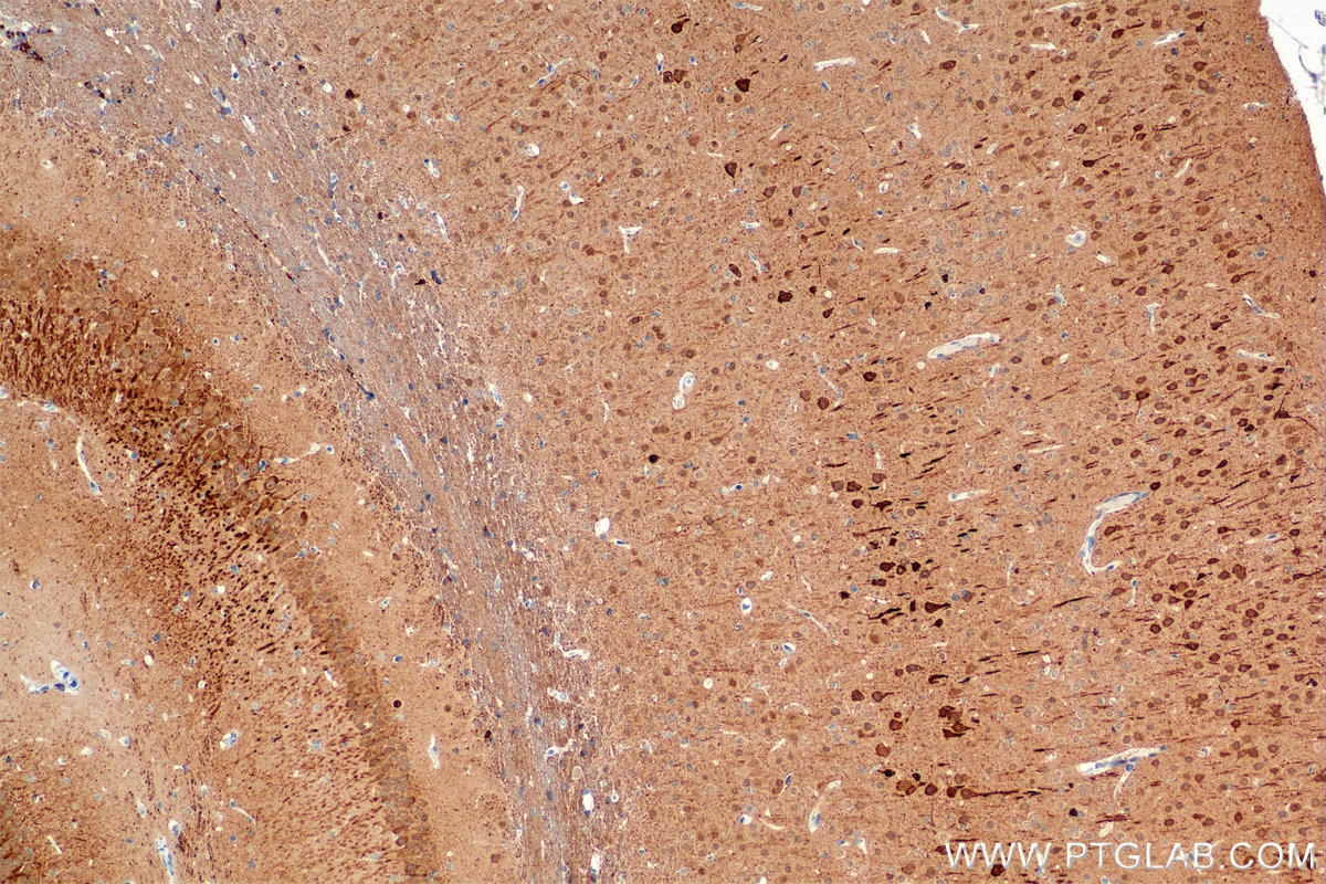 Immunohistochemistry (IHC) staining of mouse brain tissue using A2BP1 Recombinant monoclonal antibody (85732-2-RR)