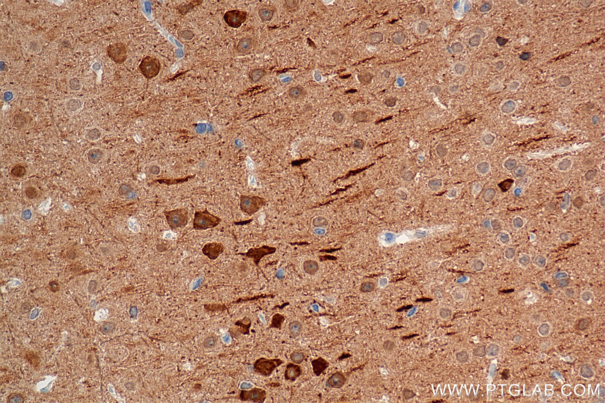 Immunohistochemistry (IHC) staining of mouse brain tissue using A2BP1 Recombinant monoclonal antibody (85732-2-RR)