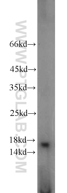 Western Blot (WB) analysis of mouse bladder tissue using A2LD1 Polyclonal antibody (23280-1-AP)