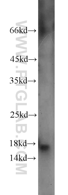 Western Blot (WB) analysis of mouse brain tissue using A2LD1 Polyclonal antibody (23280-1-AP)