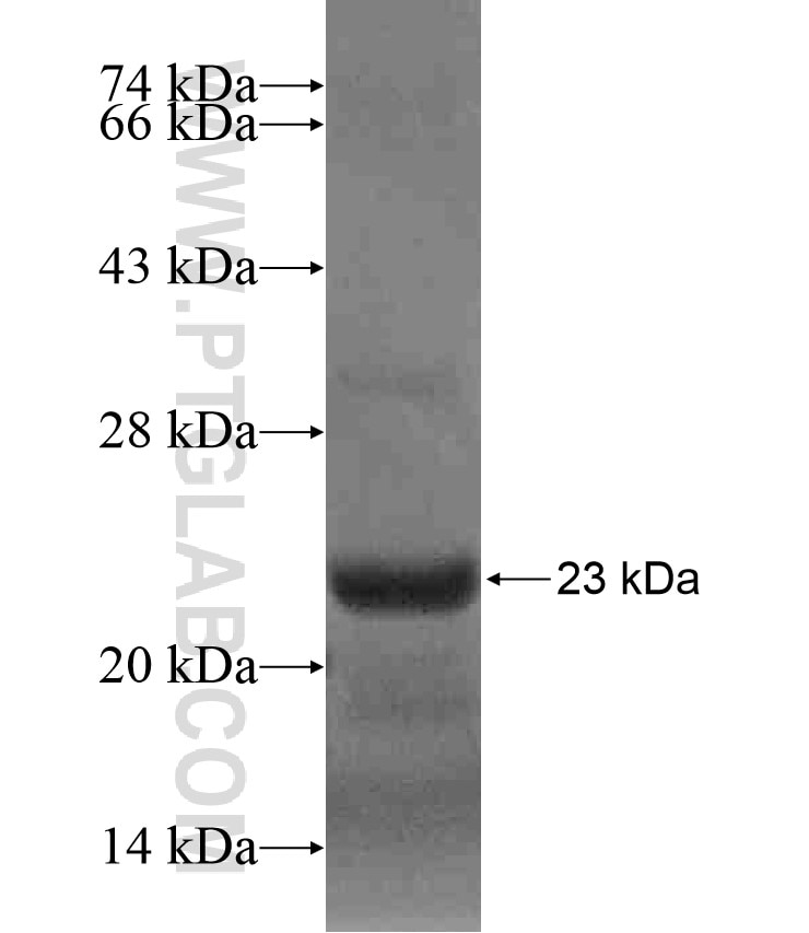 A2LD1 fusion protein Ag18549 SDS-PAGE