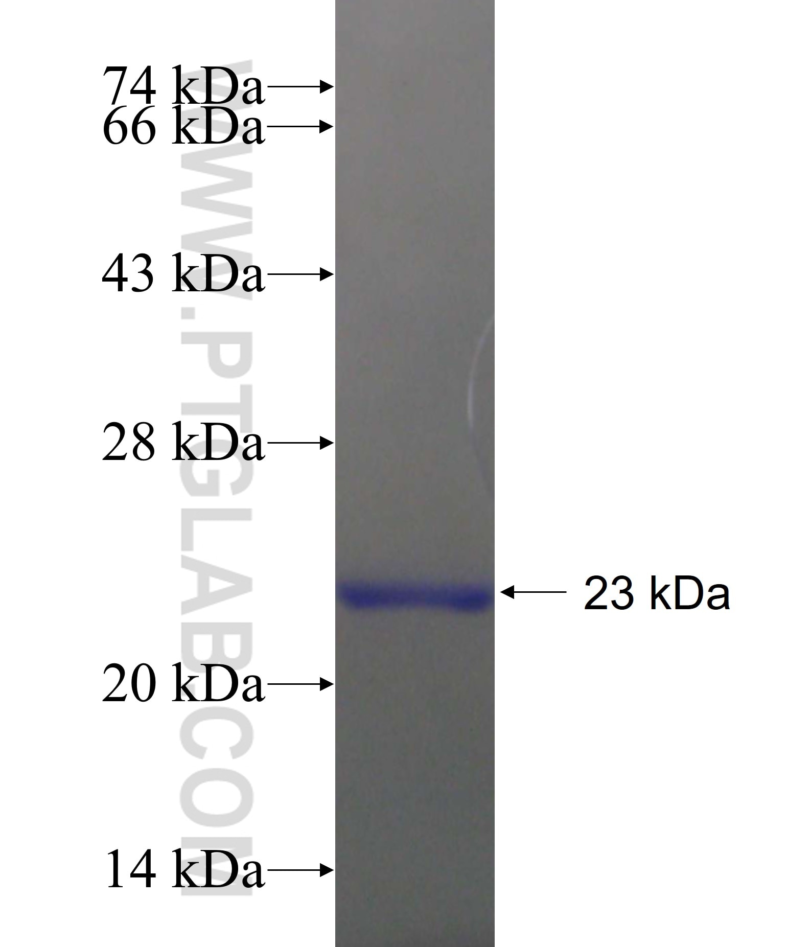 A2LD1 fusion protein Ag18549 SDS-PAGE