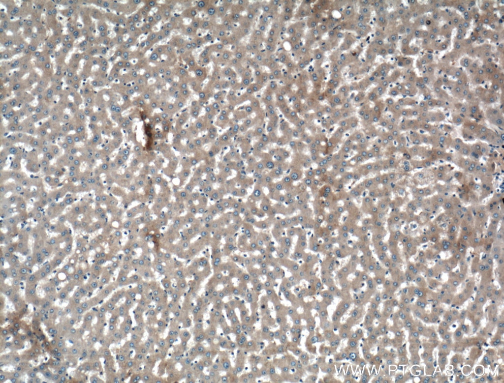 Immunohistochemistry (IHC) staining of human liver tissue using Alpha-2-Macroglobulin Polyclonal antibody (13545-1-AP)