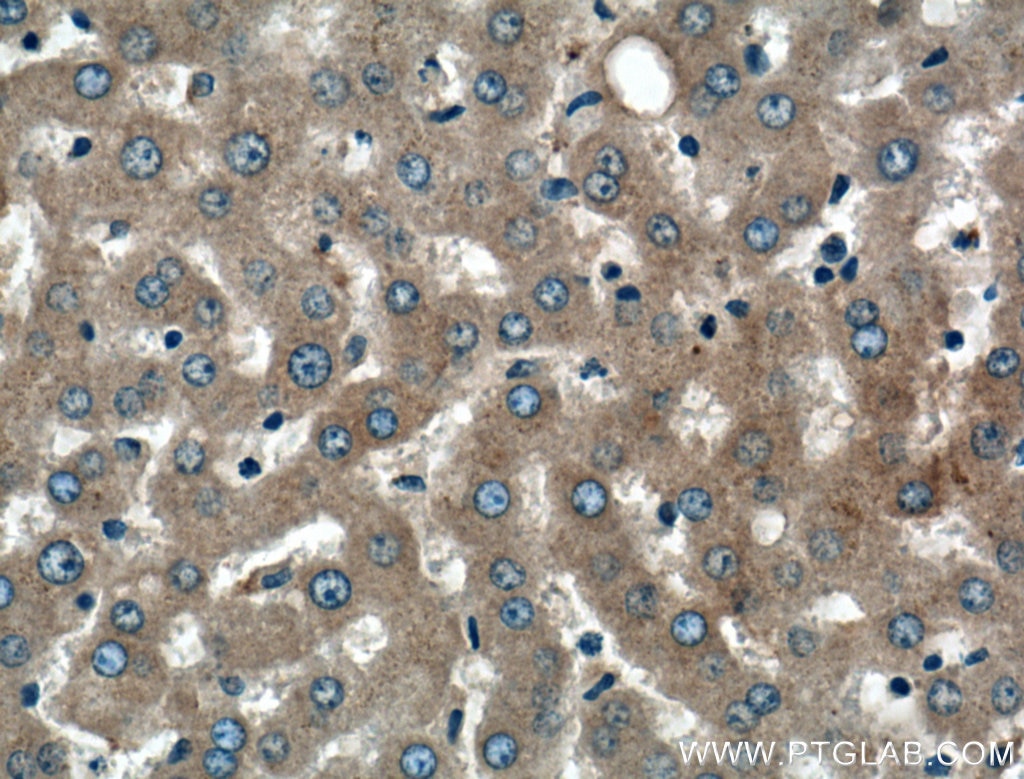 Immunohistochemistry (IHC) staining of human liver tissue using Alpha-2-Macroglobulin Polyclonal antibody (13545-1-AP)