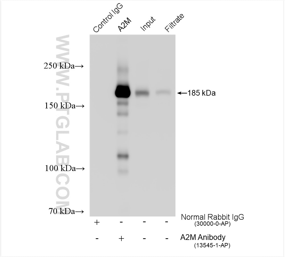 Immunoprecipitation (IP) experiment of HepG2 cells using Alpha-2-Macroglobulin Polyclonal antibody (13545-1-AP)