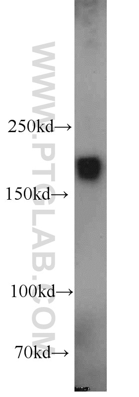 Western Blot (WB) analysis of human brain tissue using Alpha-2-Macroglobulin Polyclonal antibody (13545-1-AP)