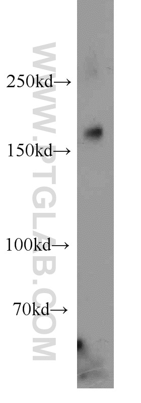 Western Blot (WB) analysis of HepG2 cells using Alpha-2-Macroglobulin Polyclonal antibody (13545-1-AP)