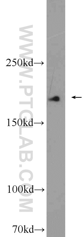 Western Blot (WB) analysis of human plasma using Alpha-2-Macroglobulin Polyclonal antibody (13545-1-AP)