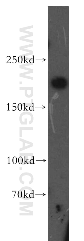 Western Blot (WB) analysis of human brain tissue using Alpha-2-Macroglobulin Polyclonal antibody (13545-1-AP)