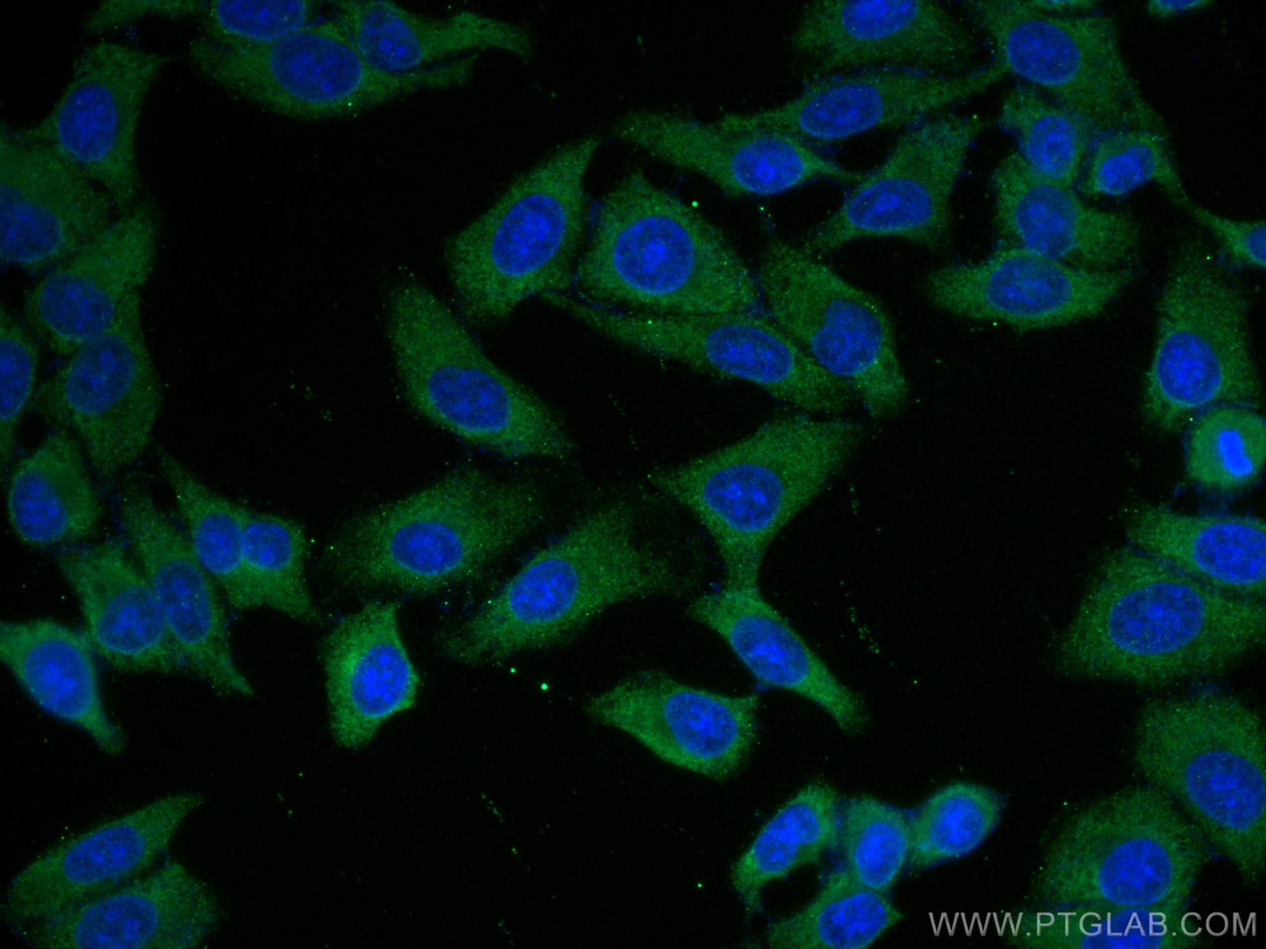 Immunofluorescence (IF) / fluorescent staining of HepG2 cells using Alpha-2-Macroglobulin Monoclonal antibody (66126-1-Ig)