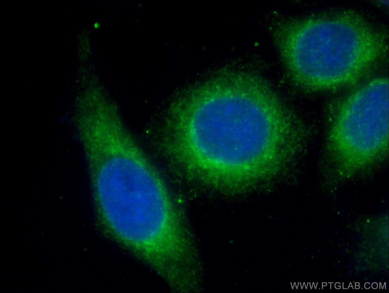 Alpha-2-Macroglobulin