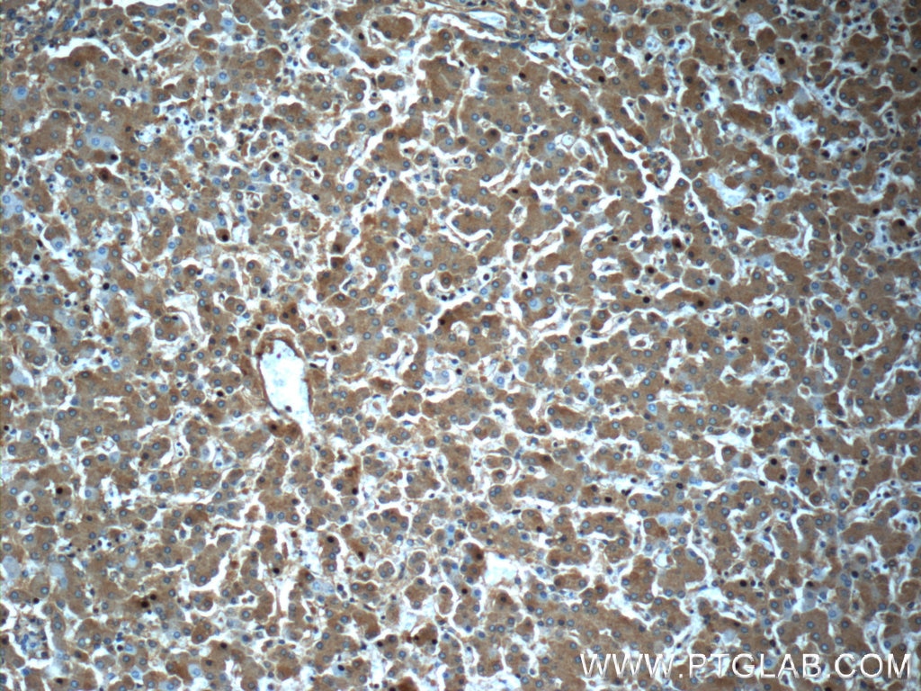 Immunohistochemistry (IHC) staining of human liver tissue using Alpha-2-Macroglobulin Monoclonal antibody (66126-1-Ig)