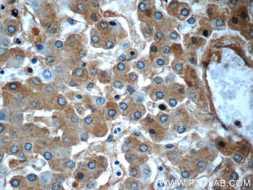 Immunohistochemistry (IHC) staining of human liver tissue using Alpha-2-Macroglobulin Monoclonal antibody (66126-1-Ig)