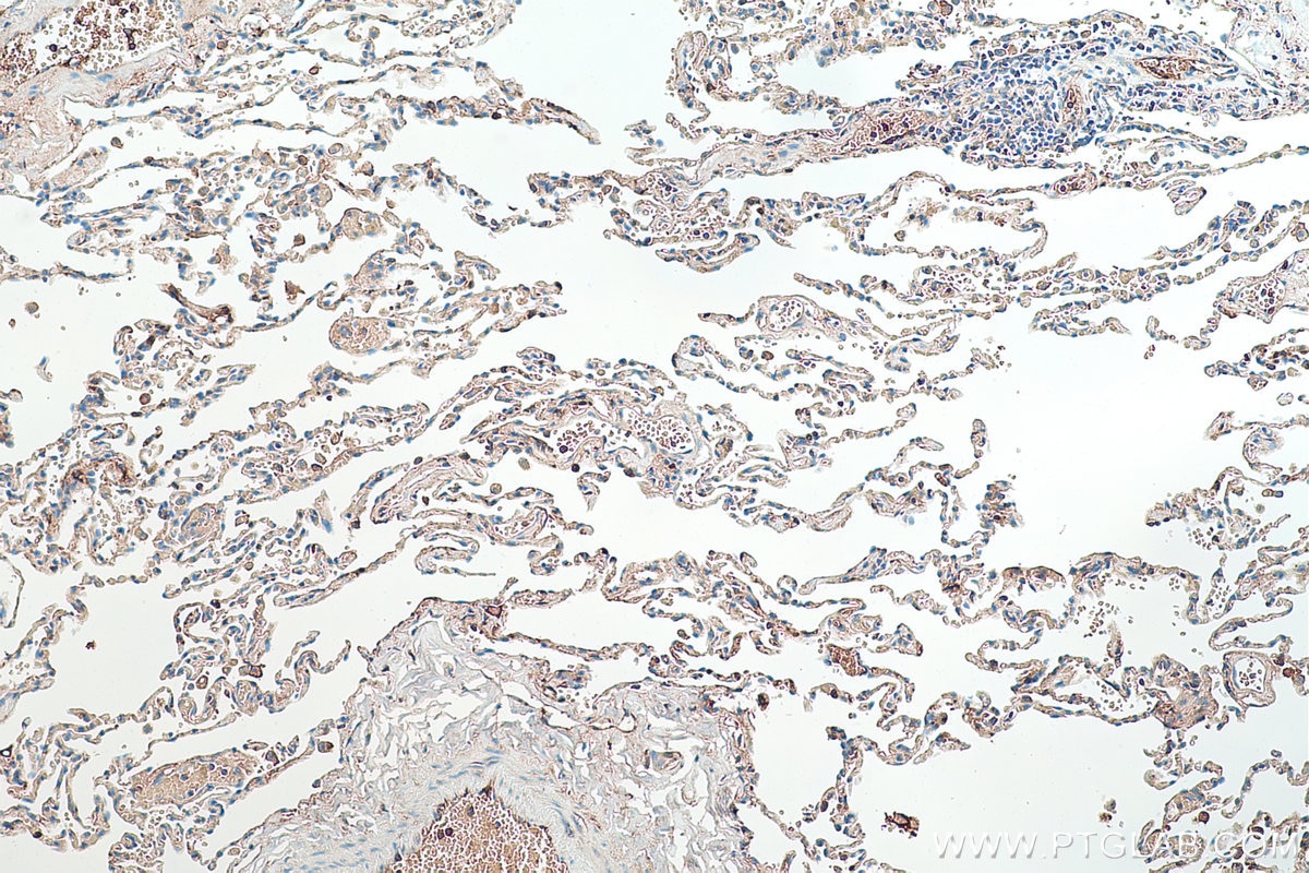 Immunohistochemistry (IHC) staining of human lung tissue using Alpha-2-Macroglobulin Monoclonal antibody (66126-1-Ig)