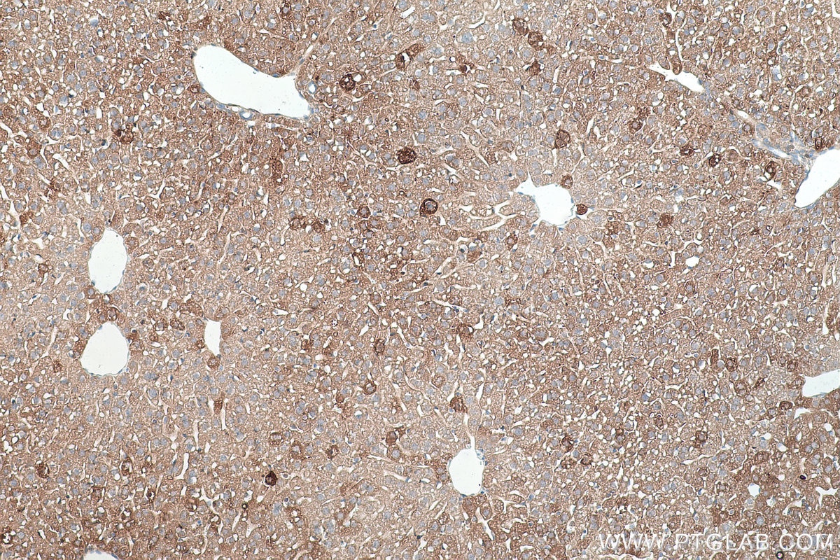 Immunohistochemistry (IHC) staining of mouse liver tissue using Alpha-2-Macroglobulin Monoclonal antibody (66126-1-Ig)