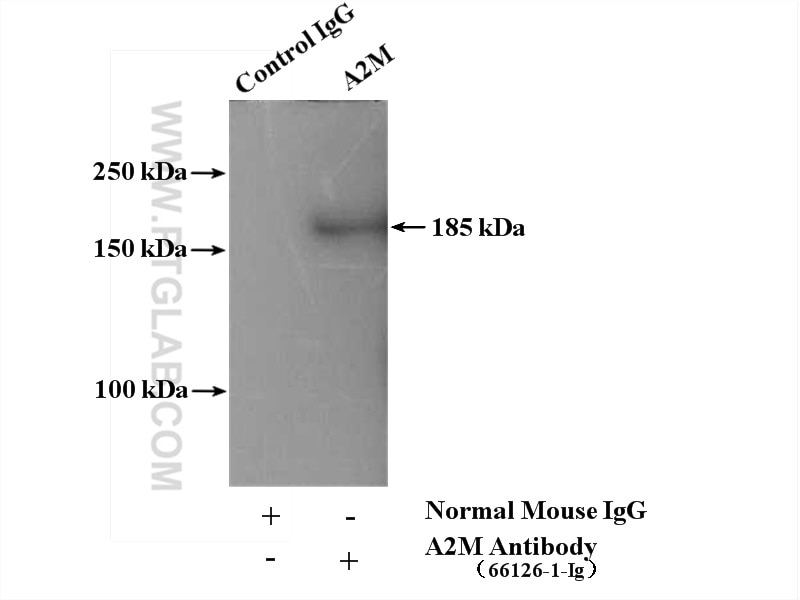 Immunoprecipitation (IP) experiment of human plasma using Alpha-2-Macroglobulin Monoclonal antibody (66126-1-Ig)