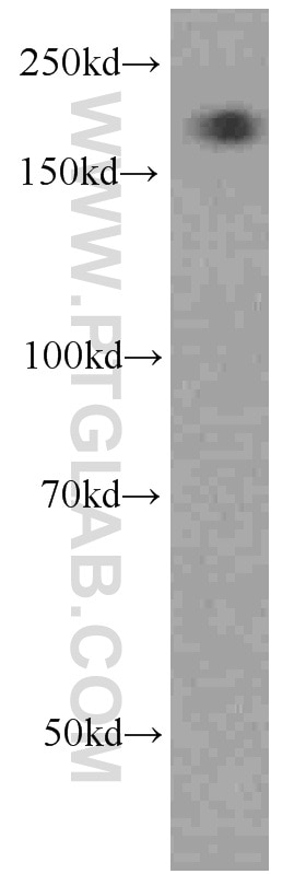 Western Blot (WB) analysis of HepG2 cells using Alpha-2-Macroglobulin Monoclonal antibody (66126-1-Ig)