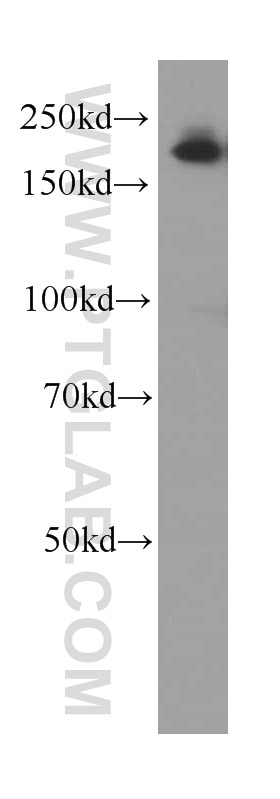 Western Blot (WB) analysis of human brain tissue using Alpha-2-Macroglobulin Monoclonal antibody (66126-1-Ig)