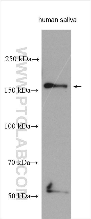 Western Blot (WB) analysis of various lysates using A2ML1 Polyclonal antibody (27674-1-AP)