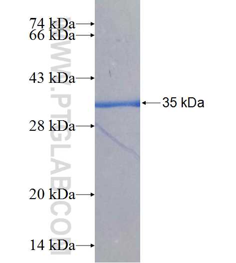 A2ML1 fusion protein Ag25818 SDS-PAGE