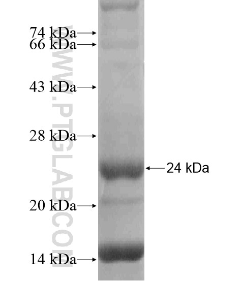 A2ML1 fusion protein Ag18656 SDS-PAGE