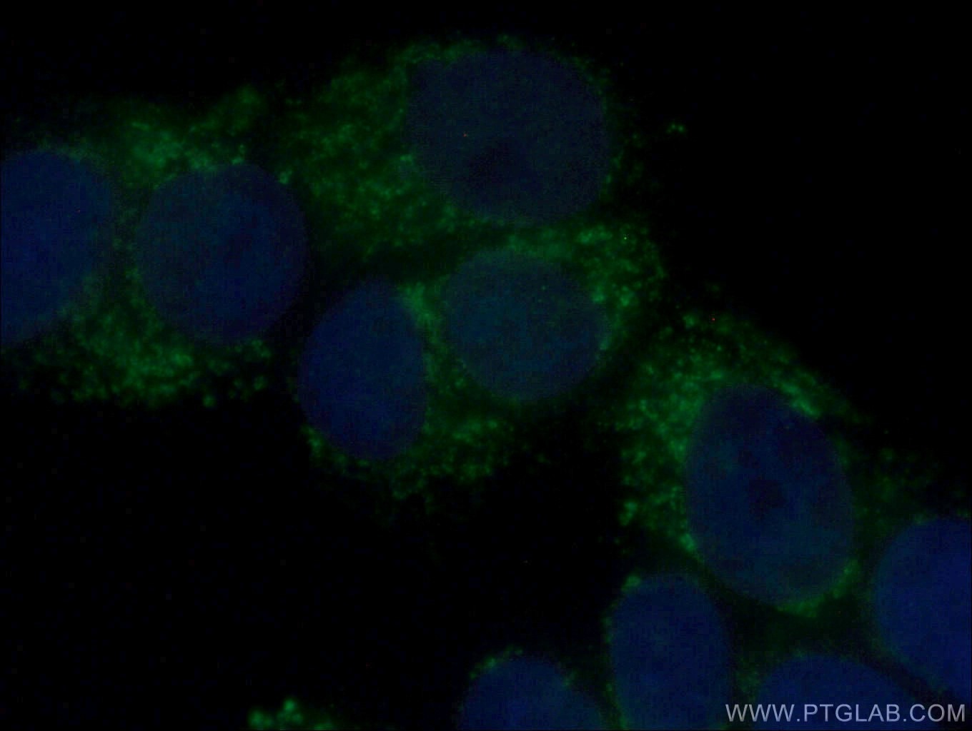 IF Staining of MCF-7 using 12392-1-AP