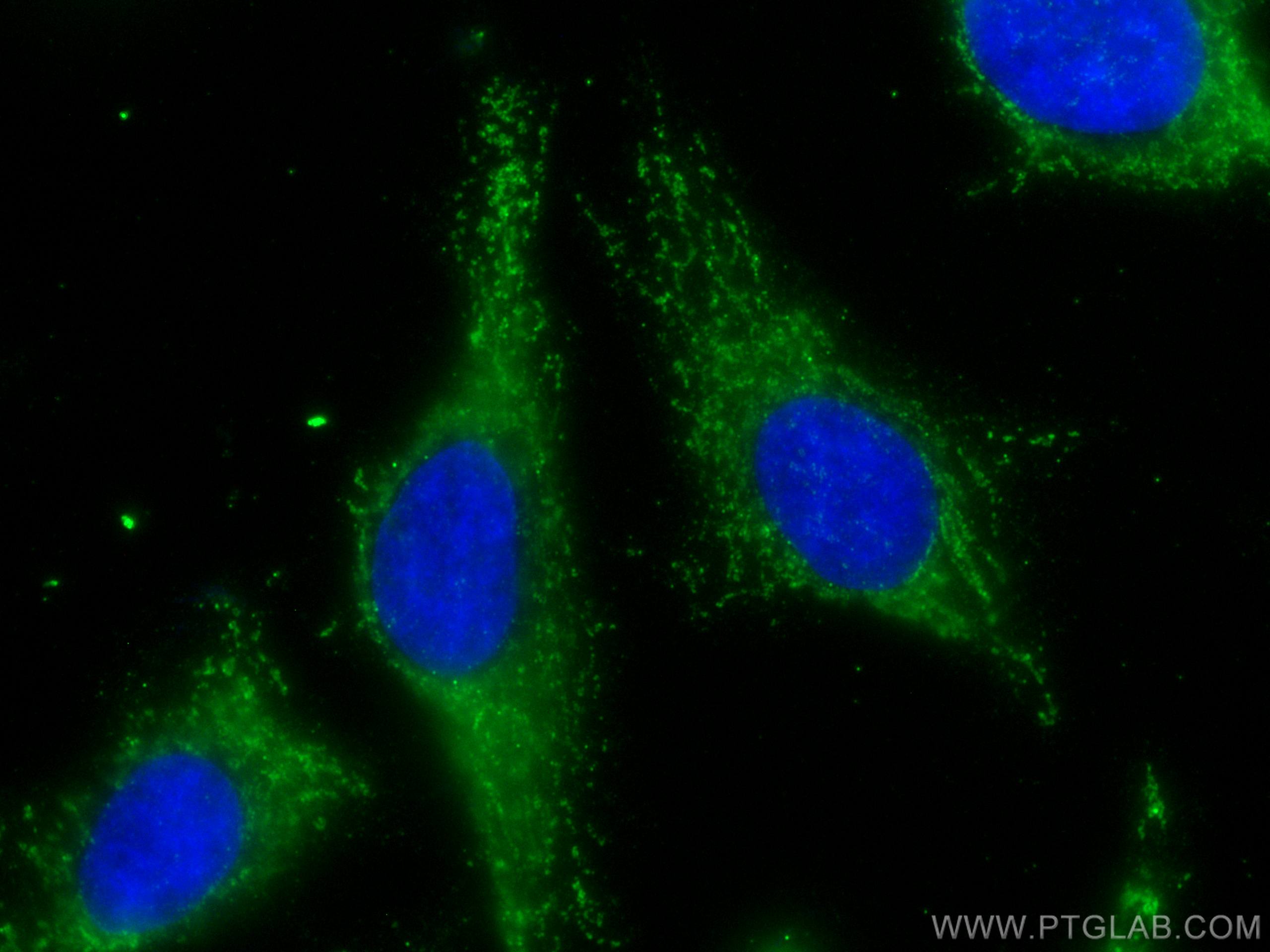 Immunofluorescence (IF) / fluorescent staining of HeLa cells using A4GALT Polyclonal antibody (12392-1-AP)