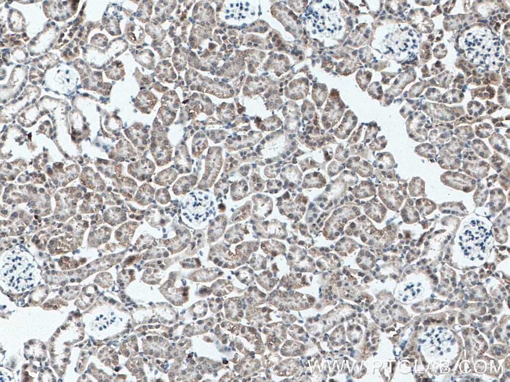 Immunohistochemistry (IHC) staining of mouse kidney tissue using A4GALT Polyclonal antibody (12392-1-AP)