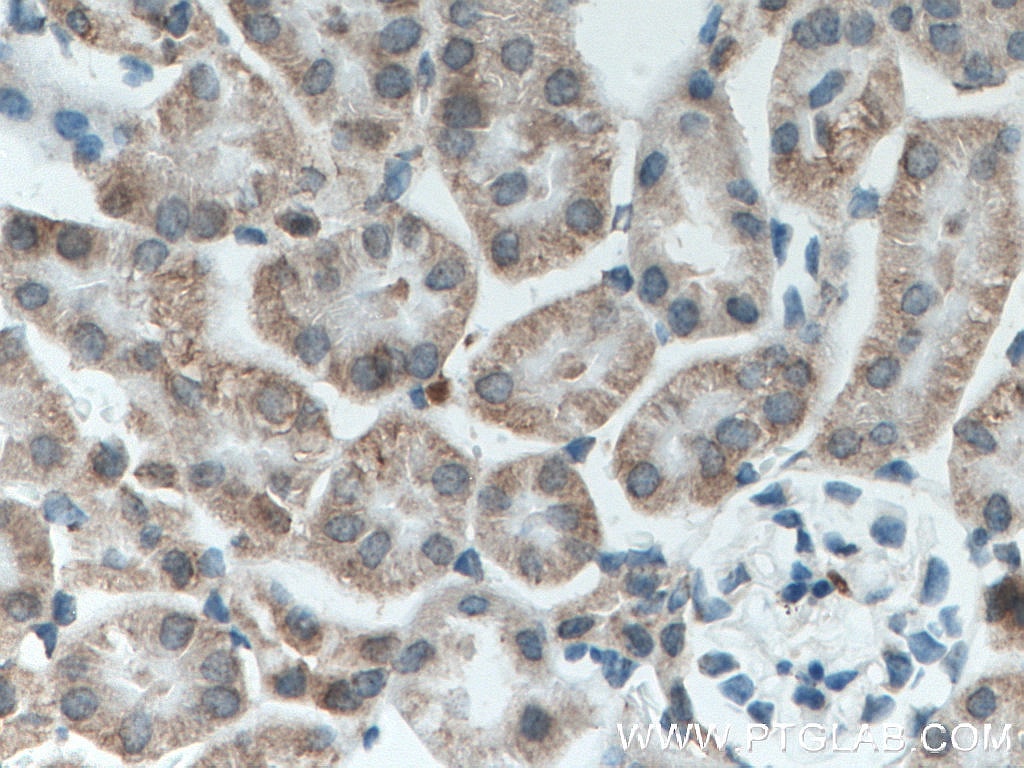 Immunohistochemistry (IHC) staining of mouse kidney tissue using A4GALT Polyclonal antibody (12392-1-AP)
