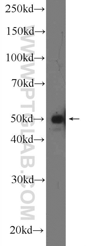 Western Blot (WB) analysis of K-562 cells using A4GALT Polyclonal antibody (12392-1-AP)
