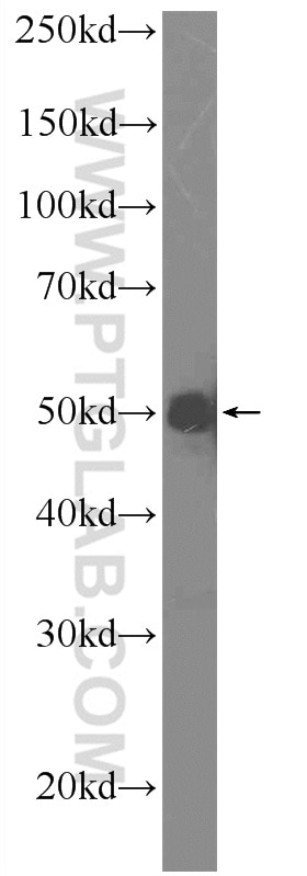 Western Blot (WB) analysis of Raji cells using A4GALT Polyclonal antibody (12392-1-AP)