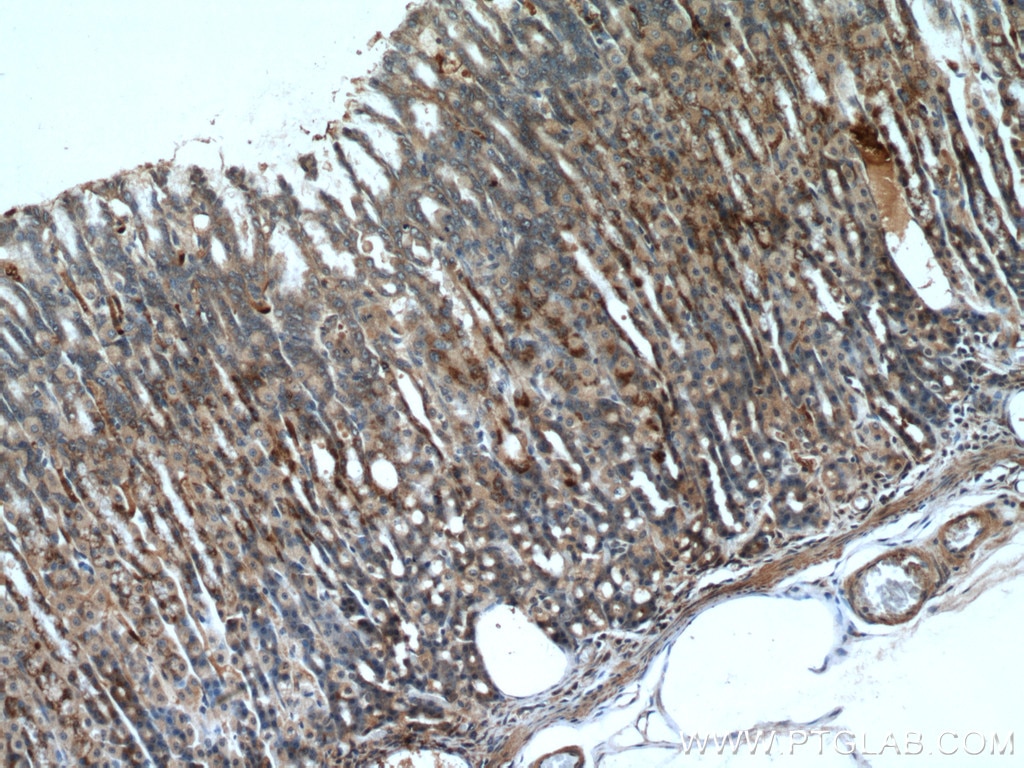 Immunohistochemistry (IHC) staining of rat stomach tissue using A4GNT Polyclonal antibody (22670-1-AP)