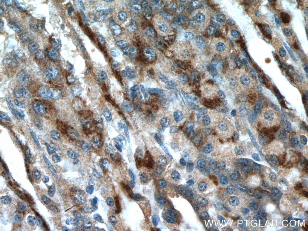 Immunohistochemistry (IHC) staining of rat stomach tissue using A4GNT Polyclonal antibody (22670-1-AP)