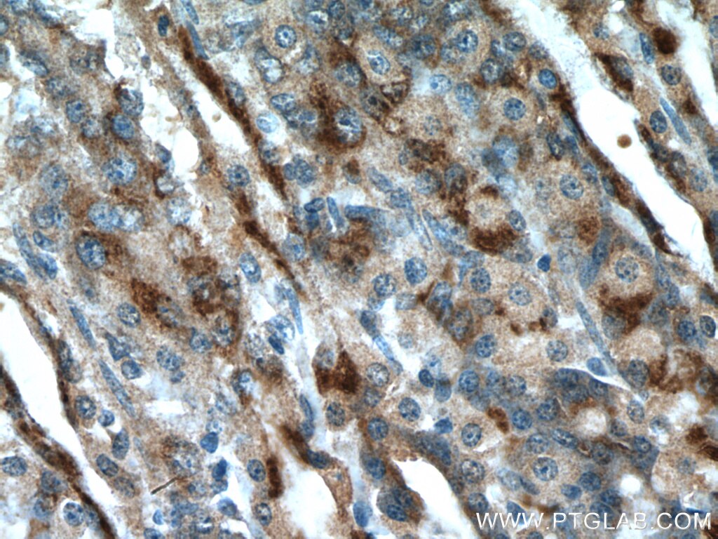 IHC staining of rat stomach using 22670-1-AP