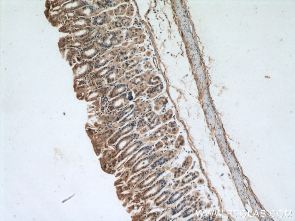 Immunohistochemistry (IHC) staining of mouse stomach tissue using A4GNT Polyclonal antibody (22670-1-AP)