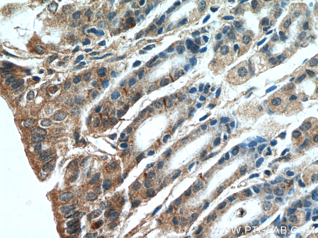 Immunohistochemistry (IHC) staining of mouse stomach tissue using A4GNT Polyclonal antibody (22670-1-AP)