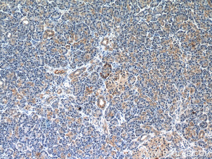 Immunohistochemistry (IHC) staining of human pancreas tissue using A4GNT Polyclonal antibody (22670-1-AP)
