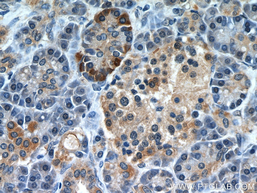 Immunohistochemistry (IHC) staining of human pancreas tissue using A4GNT Polyclonal antibody (22670-1-AP)