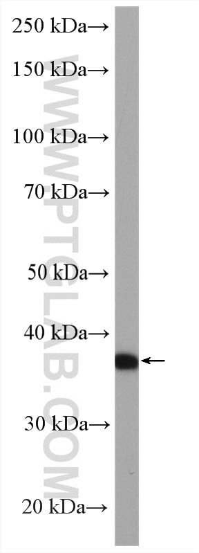 Western Blot (WB) analysis of mouse pancreas tissue using A4GNT Polyclonal antibody (22670-1-AP)
