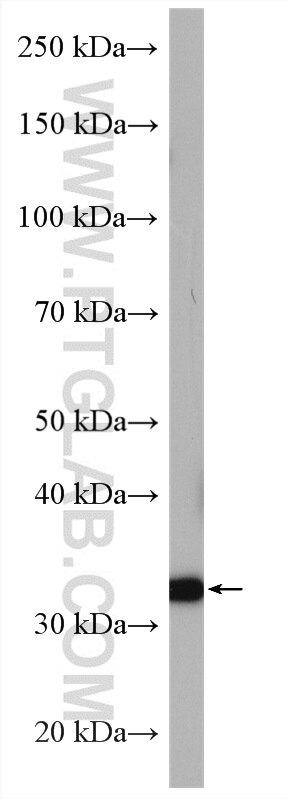 Western Blot (WB) analysis of mouse stomach tissue using A4GNT Polyclonal antibody (22670-1-AP)