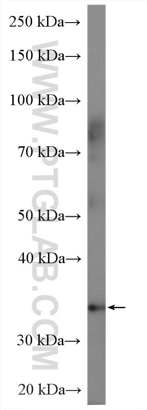 Western Blot (WB) analysis of rat stomach tissue using A4GNT Polyclonal antibody (22670-1-AP)