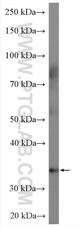 WB analysis of rat stomach using 22670-1-AP