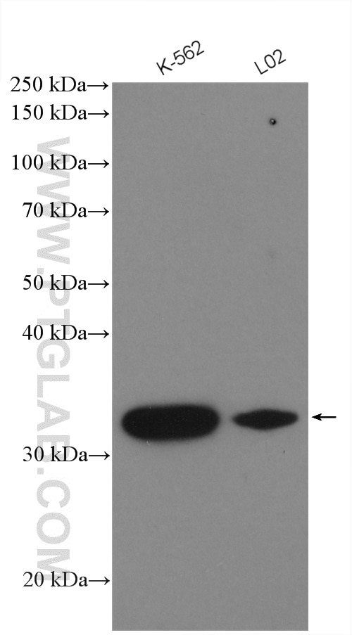 Western Blot (WB) analysis of various lysates using A4GNT Polyclonal antibody (22670-1-AP)