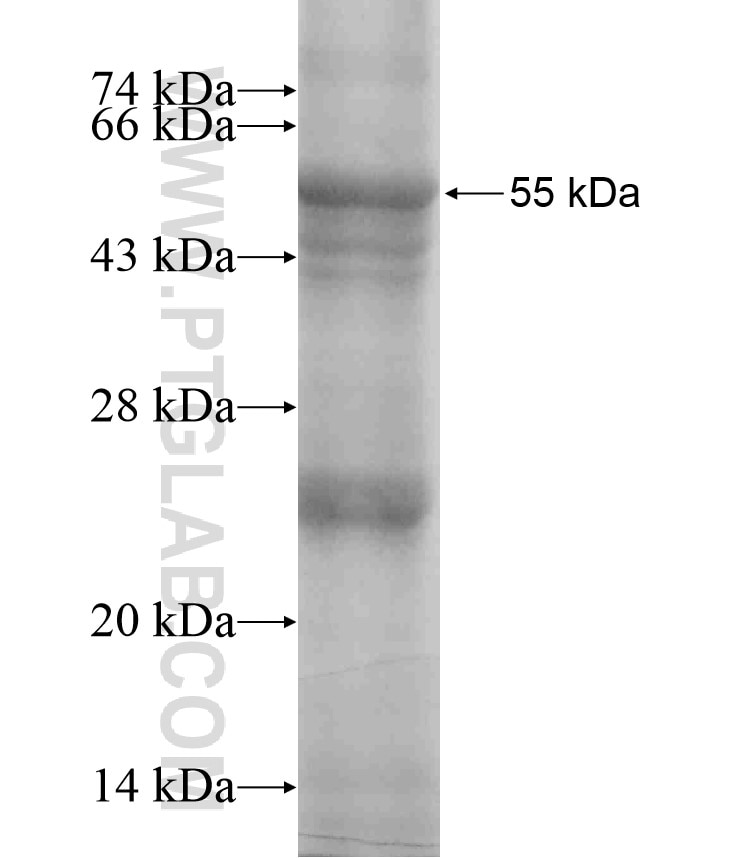 A4GNT fusion protein Ag18496 SDS-PAGE