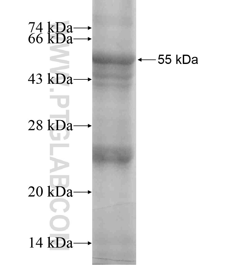 A4GNT fusion protein Ag18496 SDS-PAGE