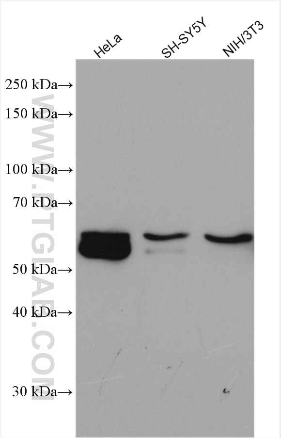 Western Blot (WB) analysis of various lysates using ALADIN Polyclonal antibody (15127-1-AP)