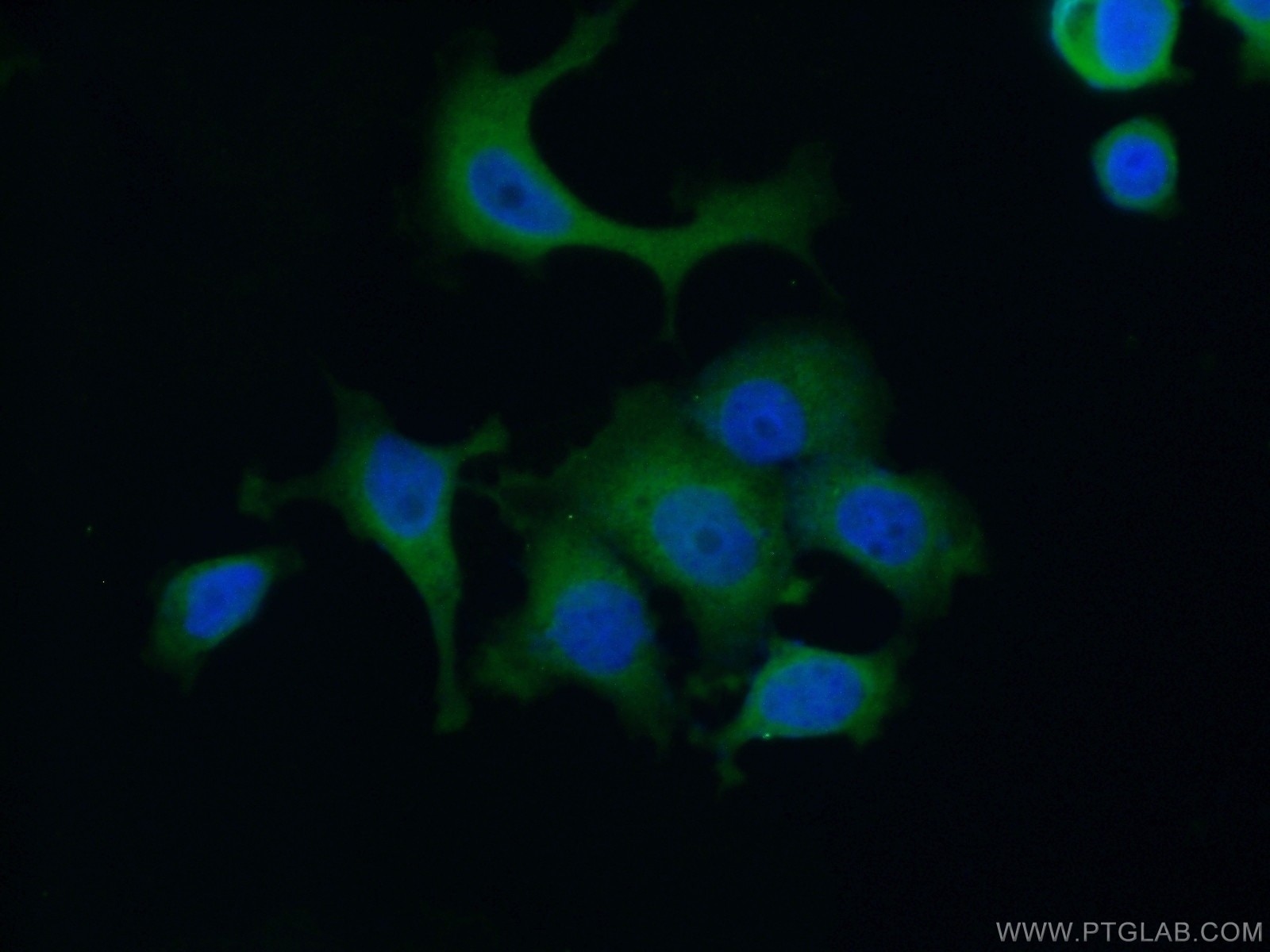 Immunofluorescence (IF) / fluorescent staining of MCF-7 cells using AACS Polyclonal antibody (13815-1-AP)